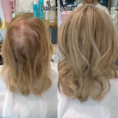 ⚡Sale Ends Tonight–🌷2026 New Lightweight & Breathable Wavy Hair Topper